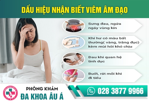 viêm âm đạo